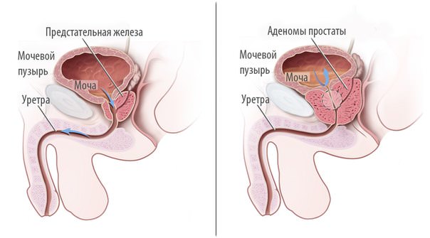 Результат 