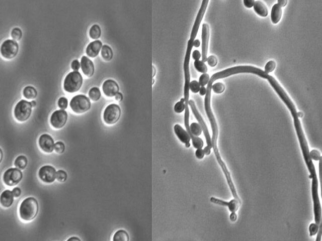 Candida albicans