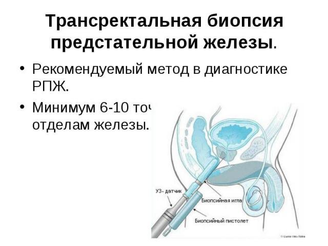 Трансректальная биопсия