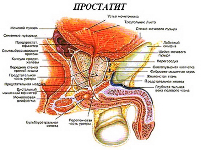 Заболевание