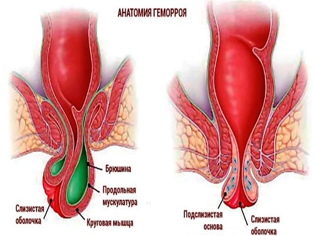 Схематический рисунок 