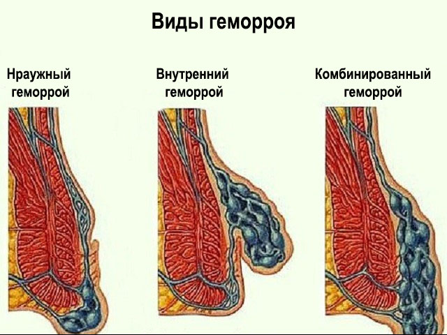 Схематический рисунок 