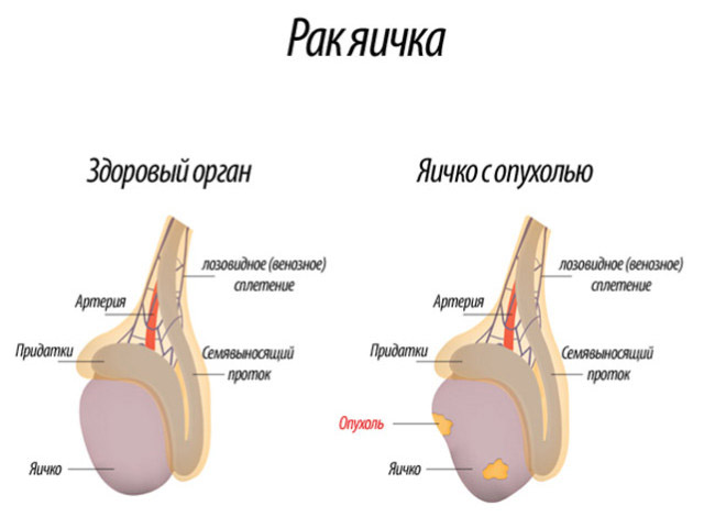 Схематический рисунок 