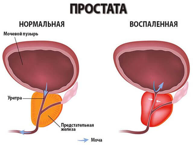 Схематический рисунок