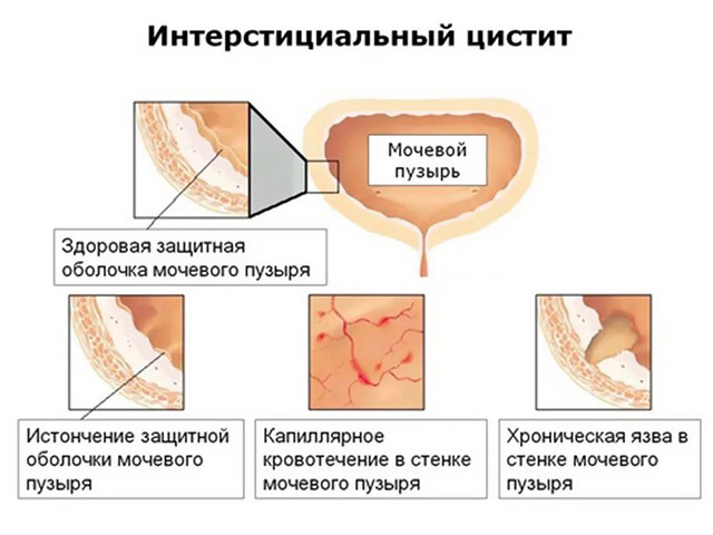 Подробный рисунок 