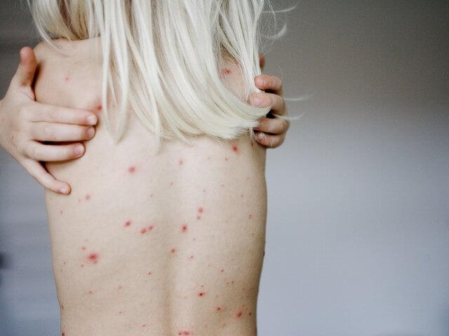 Спина девушки 