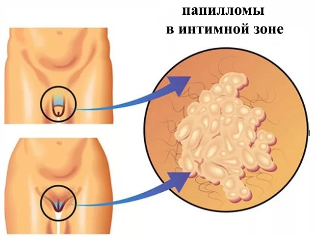 Схематический рисунок