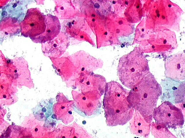 Увеличенная бактерия 