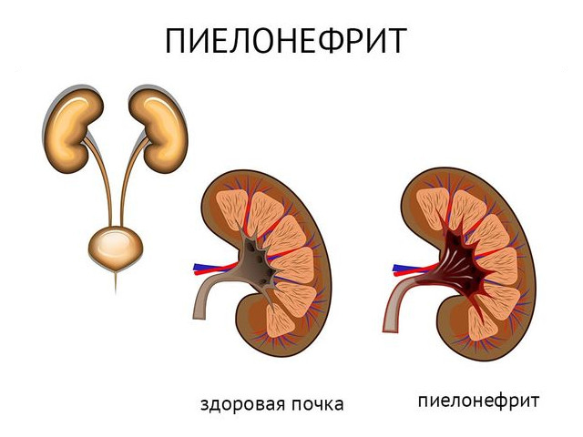 Схематический рисунок 