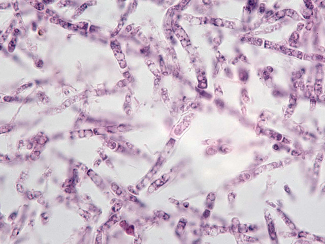 Микроорганизмы под микроскопом