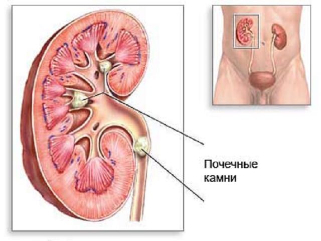 Схема почки 