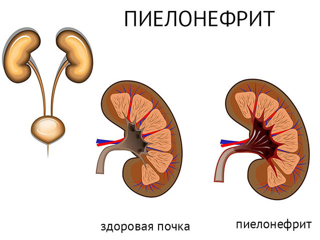 Схематический рисунок 