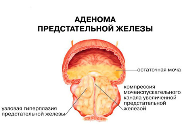 Схематический рисунок 