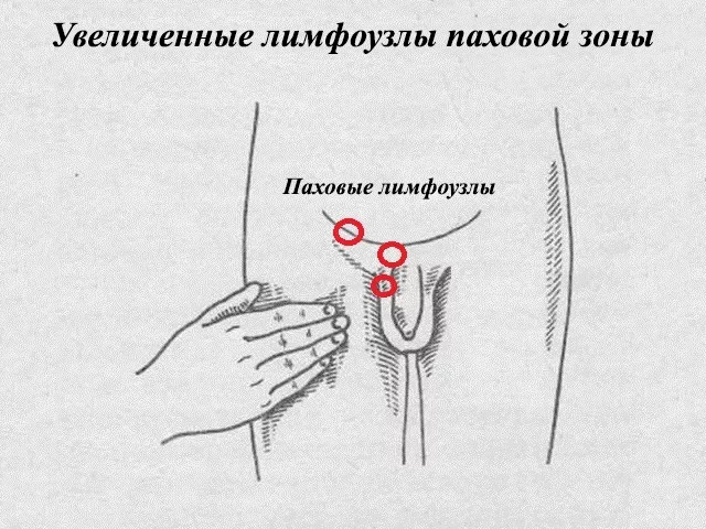 Схематический рисунок 