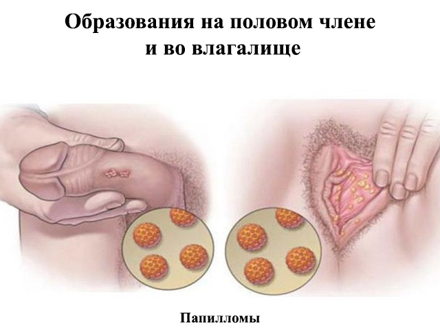 Схематический рисунок 