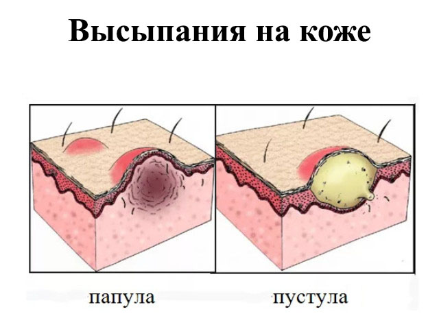 Схематический рисунок 