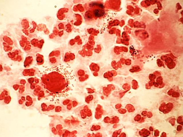 Неприятное заболевание 