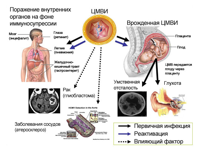 Схематический рисунок 