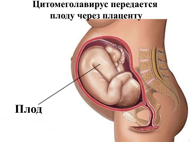 Схематический рисунок 