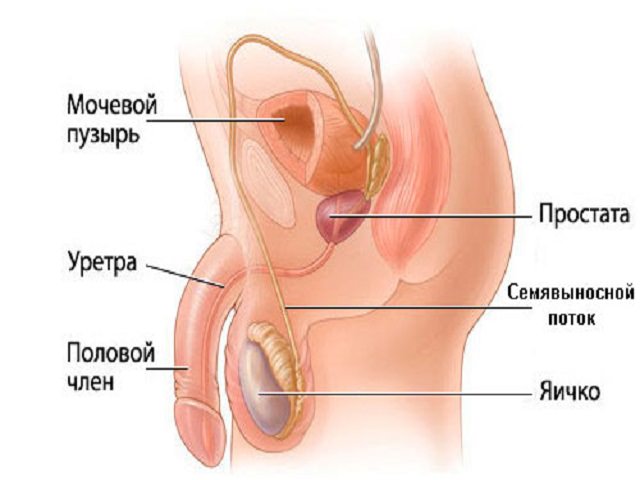 Схематический рисунок 
