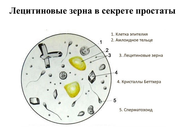 Схематический рисунок