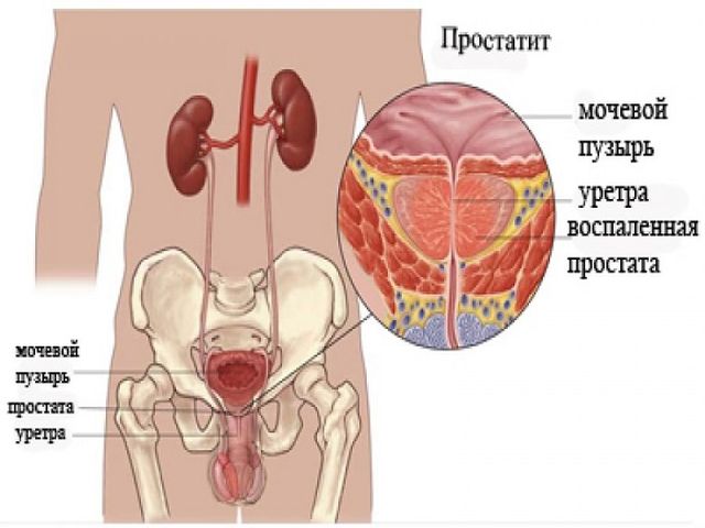 Схематический рисунок 
