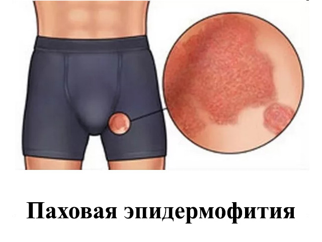 Схематический рисунок 