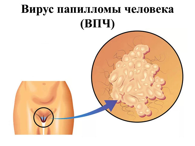 Схематический рисунок 