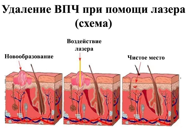 Схематический рисунок 