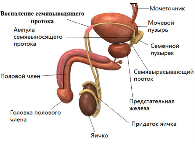 Схематический рисунок 