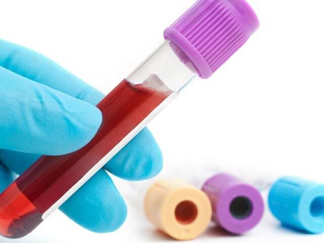 Исследование в лаборатории 