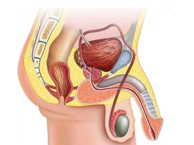 Схематический рисунок 