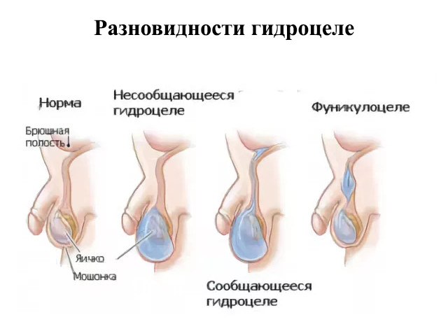 Схематический рисунок 