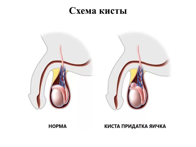 Схематический рисунок 