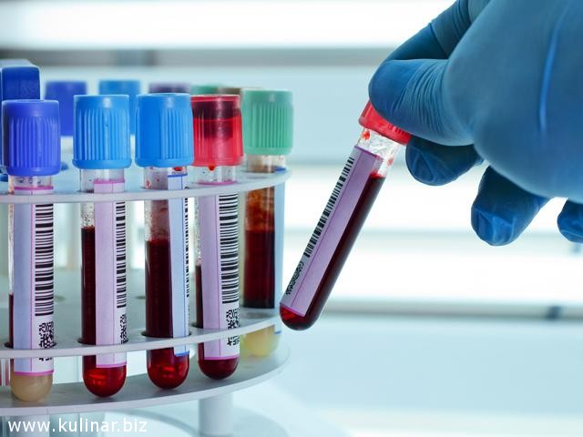 Лабораторные исследования 