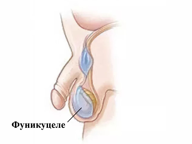 Схематический рисунок 