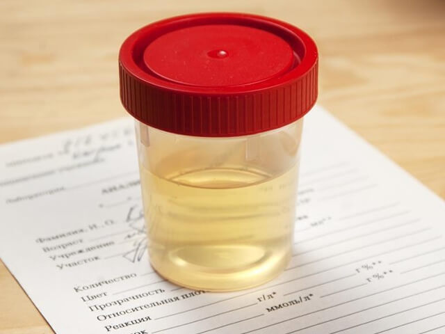 Урина для диагностики Баночка с анализами