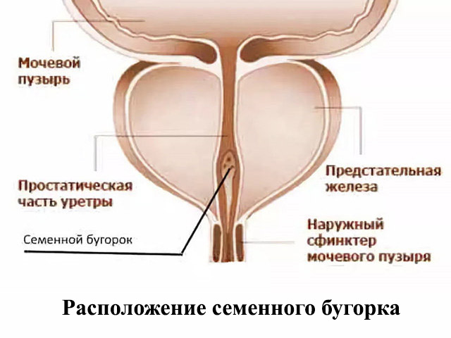 Схематический рисунок 