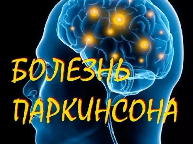 Схематический рисунок 