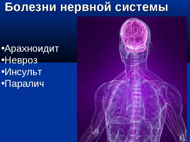 Схематический рисунок