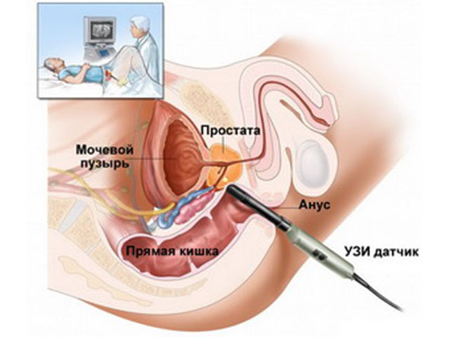 Дополнительное исследование 