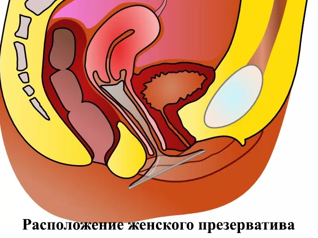 Схематический рисунок 