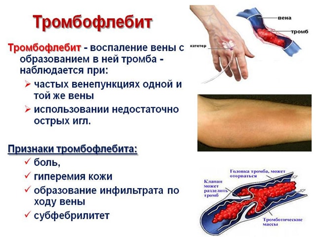 Противопоказания