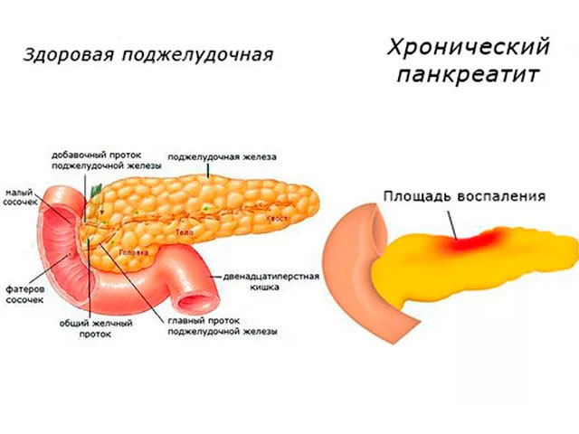 Схематический рисунок 