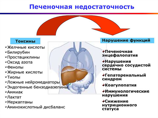 Схематический рисунок 