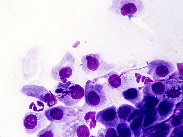 Хламидии под микроскопом Бактерии под увеличением