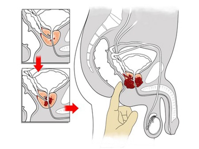 Опасность не правильного проведения 