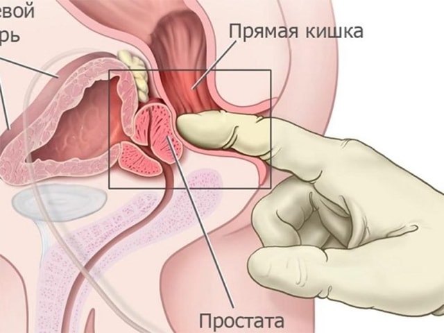 Простата