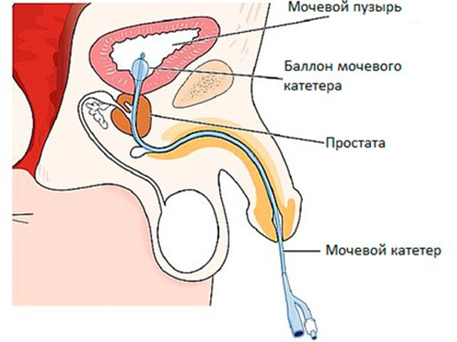 Введение коллагена