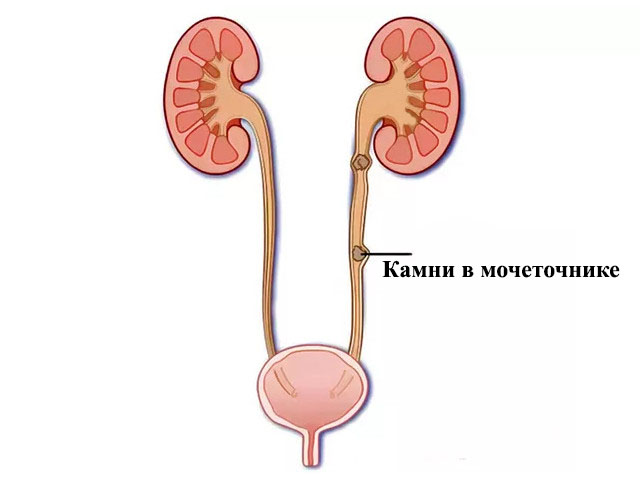 Схематический рисунок 